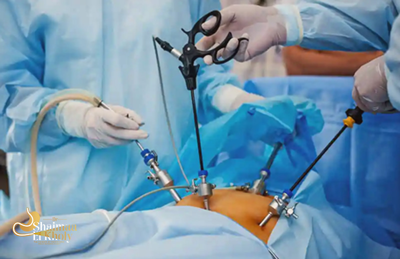 The Difference between Third Space Endoscopy and Laparoscopy